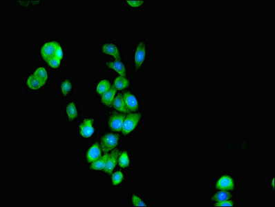 RALDH2 / ALDH1A2 Antibody - Immunofluorescent analysis of PC-3 cells using SEPSECS Antibody at dilution of 1:100 and Alexa Fluor 488-congugated AffiniPure Goat Anti-Rabbit IgG(H+L)