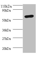 RALDH2 / ALDH1A2 Antibody - Western blot All lanes: O-phosphoseryl-tRNA (Sec) selenium transferase antibody at 2µg/ml + 293T whole cell lysate Secondary Goat polyclonal to rabbit IgG at 1/10000 dilution Predicted band size: 56, 6 kDa Observed band size: 56 kDa