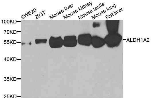 RALDH2 / ALDH1A2 Antibody - Western blot analysis of extracts of various cell lines.