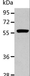 RALDH2 / ALDH1A2 Antibody - Western blot analysis of K562 cell, using ALDH1A2 Polyclonal Antibody at dilution of 1:400.
