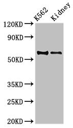 RALDH2 / ALDH1A2 Antibody - Western Blot Positive WB detected in:K562 whole cell lysate,Mouse kidney tissue All Lanes:ALDH1A2 antibody at 3.5µg/ml Secondary Goat polyclonal to rabbit IgG at 1/50000 dilution Predicted band size: 57,54,55,47 KDa Observed band size: 57 KDa