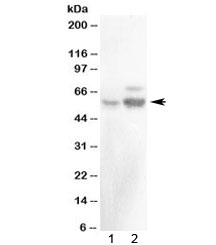 RALDH2 / ALDH1A2 Antibody - Western blot testing of 1) rat testis and 2) mouse testis with ALDH1A2 antibody at 0.5ug/ml. Expected molecular weight ~56 kDa.