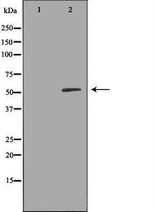 RALDH2 / ALDH1A2 Antibody - Western blot analysis of extracts of K562 cells using ALDH1A2 antibody. The lane on the left is treated with the antigen-specific peptide.