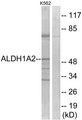 RALDH2 / ALDH1A2 Antibody - Western blot analysis of extracts from K562 cells, using ALDH1A2 antibody.