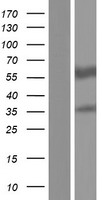 RALDH2 / ALDH1A2 Protein - Western validation with an anti-DDK antibody * L: Control HEK293 lysate R: Over-expression lysate