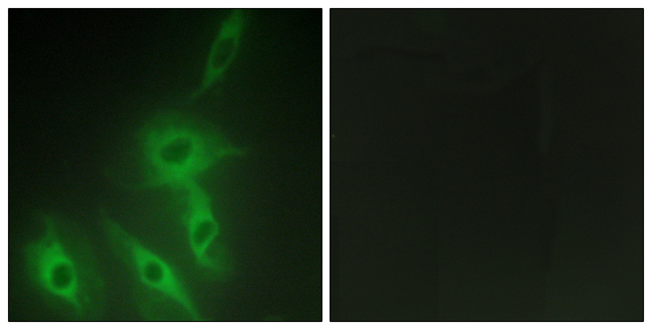 RALGAPA2 Antibody - Immunofluorescence analysis of HeLa cells, using AS250 Antibody. The picture on the right is blocked with the synthesized peptide.