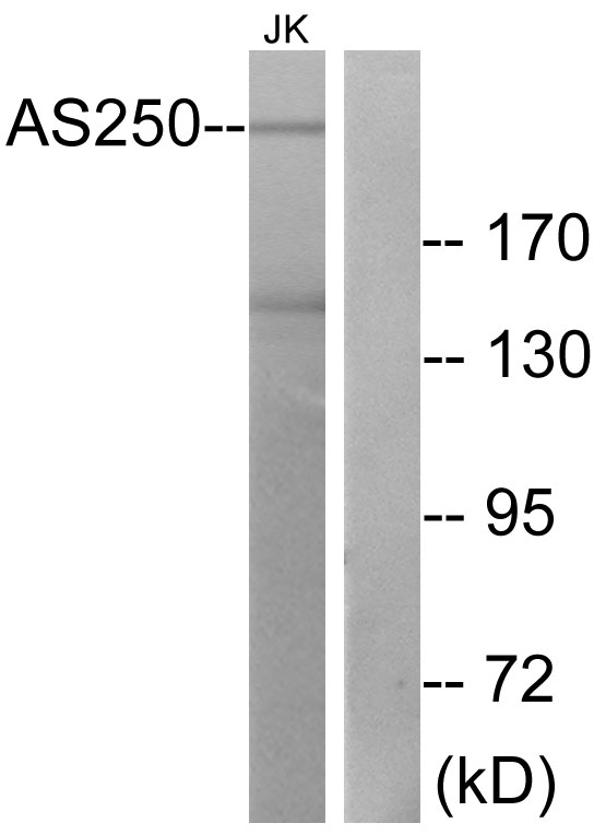 RALGAPA2 Antibody - Western blot analysis of lysates from Jurkat cells, using AS250 Antibody. The lane on the right is blocked with the synthesized peptide.