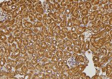 RALGAPA2 Antibody - 1:100 staining mouse kidney tissue by IHC-P. The sample was formaldehyde fixed and a heat mediated antigen retrieval step in citrate buffer was performed. The sample was then blocked and incubated with the antibody for 1.5 hours at 22°C. An HRP conjugated goat anti-rabbit antibody was used as the secondary.