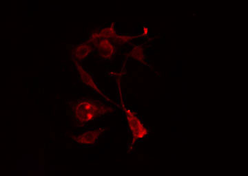 RALGAPA2 Antibody - Staining HeLa cells by IF/ICC. The samples were fixed with PFA and permeabilized in 0.1% Triton X-100, then blocked in 10% serum for 45 min at 25°C. The primary antibody was diluted at 1:200 and incubated with the sample for 1 hour at 37°C. An Alexa Fluor 594 conjugated goat anti-rabbit IgG (H+L) antibody, diluted at 1/600, was used as secondary antibody.