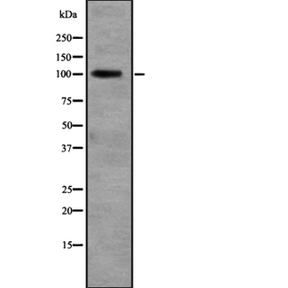 RALGDS Antibody - Western blot analysis of RALGDS expression in liver tissue (human) tissue Lysate. The lane on the left is treated with the antigen-specific peptide.