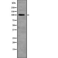 RALGDS Antibody - Western blot analysis of RALGDS expression in liver tissue (human) tissue Lysate. The lane on the left is treated with the antigen-specific peptide.