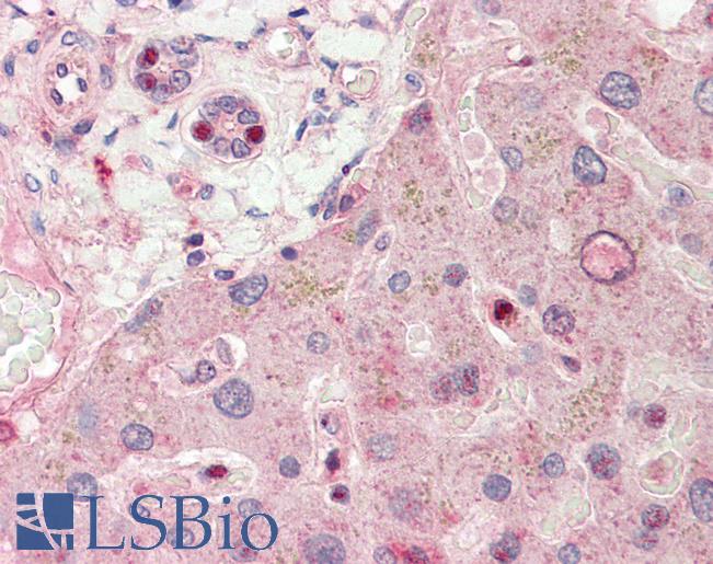 RALGPS1 Antibody - Anti-RALGPS1 antibody IHC staining of human liver. Immunohistochemistry of formalin-fixed, paraffin-embedded tissue after heat-induced antigen retrieval. Antibody concentration 5 ug/ml.  This image was taken for the unconjugated form of this product. Other forms have not been tested.