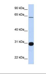 RALGPS1 Antibody - Fetal brain lysate. Antibody concentration: 1.0 ug/ml. Gel concentration: 12%.  This image was taken for the unconjugated form of this product. Other forms have not been tested.