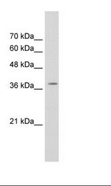 RALY Antibody - Jurkat Cell Lysate.  This image was taken for the unconjugated form of this product. Other forms have not been tested.