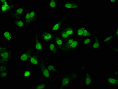 RALY Antibody - Immunofluorescence staining of Hela cells at a dilution of 1:167, counter-stained with DAPI. The cells were fixed in 4% formaldehyde, permeabilized using 0.2% Triton X-100 and blocked in 10% normal Goat Serum. The cells were then incubated with the antibody overnight at 4°C.The secondary antibody was Alexa Fluor 488-congugated AffiniPure Goat Anti-Rabbit IgG (H+L) .