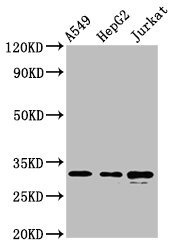 RALY Antibody - Positive Western Blot detected in A549 whole cell lysate, HepG2 whole cell lysate, Jurkat whole cell lysate. All lanes: RALY antibody at 5.7 µg/ml Secondary Goat polyclonal to rabbit IgG at 1/50000 dilution. Predicted band size: 33, 31 KDa. Observed band size: 33 KDa