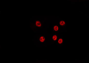 RALY Antibody - Staining HepG2 cells by IF/ICC. The samples were fixed with PFA and permeabilized in 0.1% Triton X-100, then blocked in 10% serum for 45 min at 25°C. The primary antibody was diluted at 1:200 and incubated with the sample for 1 hour at 37°C. An Alexa Fluor 594 conjugated goat anti-rabbit IgG (H+L) Ab, diluted at 1/600, was used as the secondary antibody.