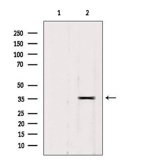 RALY Antibody - Western blot analysis of extracts of 293 cells using RALY antibody. Lane 1 was treated with the blocking peptide.