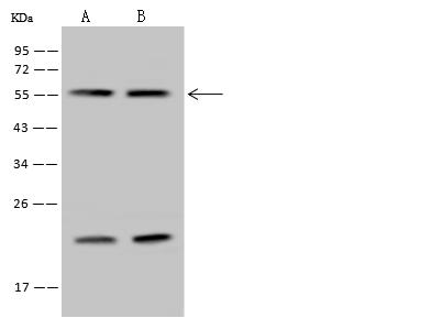 RALY Antibody - Anti-RALY rabbit polyclonal antibody at 1:500 dilution. Lane A: HeLa Whole Cell Lysate. Lane B: HepG2 Whole Cell Lysate. Lane C: Jurkat Whole Cell Lysate. Lane D: A549 Whole Cell Lysate. Lysates/proteins at 30 ug per lane. Secondary: Goat Anti-Rabbit IgG (H+L)/HRP at 1/10000 dilution. Developed using the ECL technique. Performed under reducing conditions. Predicted band size: 32 kDa. Observed band size: 37 kDa.