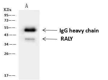 RALY Antibody - RALY was immunoprecipitated using: Lane A: 0.5 mg Jurkat Whole Cell Lysate. 4 uL anti-RALY rabbit polyclonal antibody and 60 ug of Immunomagnetic beads Protein A/G. Primary antibody: Anti-RALY rabbit polyclonal antibody, at 1:100 dilution. Secondary antibody: Goat Anti-Rabbit IgG (H+L)/HRP at 1/10000 dilution. Developed using the ECL technique. Performed under reducing conditions. Predicted band size: 32 kDa. Observed band size: 40 kDa.