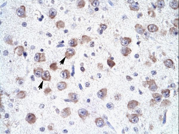RALY Antibody - RALY antibody ARP34074_P050-NP_031393-RALY Antibody was used in IHC to stain formalin-fixed, paraffin-embedded human brain.  This image was taken for the unconjugated form of this product. Other forms have not been tested.