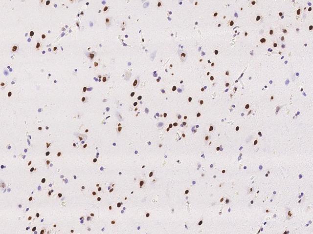 RALYL Antibody - Immunochemical staining of human RALYL in human brain with rabbit polyclonal antibody at 1:500 dilution, formalin-fixed paraffin embedded sections.