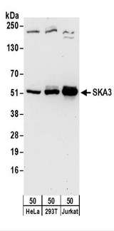 RAMA1 / SKA3 Antibody - Detection of Human SKA3 by Western Blot. Samples: Whole cell lysate (50 ug) from HeLa, 293T, and Jurkat cells. Antibodies: Affinity purified rabbit anti-SKA3 antibody used for WB at 0.1 ug/ml. Detection: Chemiluminescence with an exposure time of 30 seconds.