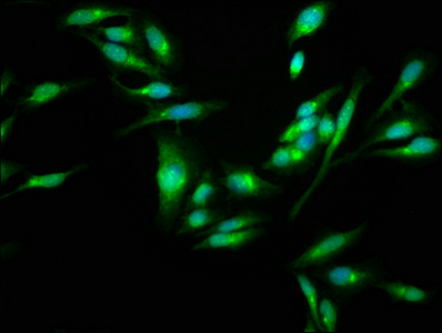 RAMA1 / SKA3 Antibody - Immunofluorescence staining of Hela cells at a dilution of 1:100, counter-stained with DAPI. The cells were fixed in 4% formaldehyde, permeabilized using 0.2% Triton X-100 and blocked in 10% normal Goat Serum. The cells were then incubated with the antibody overnight at 4 °C.The secondary antibody was Alexa Fluor 488-congugated AffiniPure Goat Anti-Rabbit IgG (H+L) .