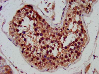 RAMA1 / SKA3 Antibody - Immunohistochemistry image at a dilution of 1:300 and staining in paraffin-embedded human testis tissue performed on a Leica BondTM system. After dewaxing and hydration, antigen retrieval was mediated by high pressure in a citrate buffer (pH 6.0) . Section was blocked with 10% normal goat serum 30min at RT. Then primary antibody (1% BSA) was incubated at 4 °C overnight. The primary is detected by a biotinylated secondary antibody and visualized using an HRP conjugated SP system.