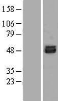 RAMA1 / SKA3 Protein - Western validation with an anti-DDK antibody * L: Control HEK293 lysate R: Over-expression lysate