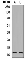 RAMP1 Antibody - Western blot analysis of RAMP1 expression in HeLa (A); NIH3T3 (B); H9C2 (C) whole cell lysates.