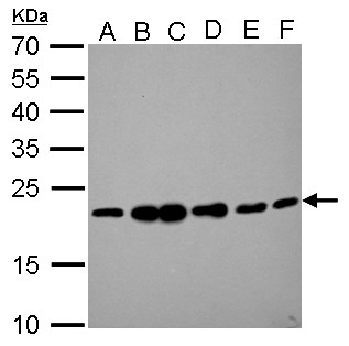 RAMP2 Antibody - RAMP2 antibody detects RAMP2 protein by Western blot analysis. A. 30 ug Jurkat whole cell lysate/extract. B. 30 ug Raji whole cell lysate/extract. C. 30 ug K562 whole cell lysate/extract. D. 30 ug THP-1 whole cell lysate/extract. E. 30 ug HL-60 whole cell lysate/extract. F. 30 ug NCI-H929 whole cell lysate/extract. 12 % SDS-PAGE. RAMP2 antibody dilution:1:1000
