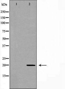 RAMP2 Antibody - Western blot analysis of HeLa cell lysates using RAMP2 antibody. The lane on the left is treated with the antigen-specific peptide.