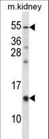 RAMP3 Antibody - RAMP3 Antibody western blot of mouse kidney tissue lysates (35 ug/lane). The RAMP3 antibody detected the RAMP3 protein (arrow).