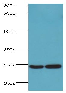 RAN Antibody - Western blot. All lanes: GTP-binding nuclear protein Ran antibody at 2 ug/ml. Lane 1: HeLa whole cell lysate. Lane 2: Jurkat whole cell lysate. Secondary antibody: Goat polyclonal to rabbit at 1:10000 dilution. Predicted band size: 24 kDa. Observed band size: 24 kDa Immunohistochemistry.