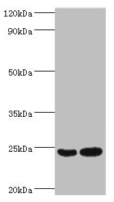 RAN Antibody - Western blot All lanes: RAN antibody at 2µg/ml Lane 1: Hela whole cell lysate Lane 2: Jurkat whole cell lysate Secondary Goat polyclonal to rabbit IgG at 1/10000 dilution Predicted band size: 24 kDa Observed band size: 24 kDa