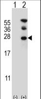 RAN Antibody - Western blot of RAN (arrow) using rabbit polyclonal RAN Antibody. 293 cell lysates (2 ug/lane) either nontransfected (Lane 1) or transiently transfected (Lane 2) with the RAN gene.