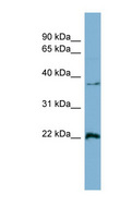 RAN Antibody - RAN antibody Western blot of HepG2 cell lysate. This image was taken for the unconjugated form of this product. Other forms have not been tested.