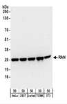 RAN Antibody - Detection of Human and Mouse RAN by Western Blot. Samples: Whole cell lysate (50 ug) from HeLa, 293T, Jurkat, mouse TCMK-1, and mouse NIH3T3 cells. Antibodies: Affinity purified rabbit anti-RAN antibody used for WB at 0.1 ug/ml. Detection: Chemiluminescence with an exposure time of 30 seconds.