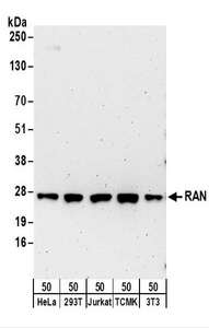RAN Antibody - Detection of Human and Mouse RAN by Western Blot. Samples: Whole cell lysate (50 ug) from HeLa, 293T, Jurkat, mouse TCMK-1, and mouse NIH3T3 cells. Antibodies: Affinity purified rabbit anti-RAN antibody used for WB at 0.1 ug/ml. Detection: Chemiluminescence with an exposure time of 3 minutes.