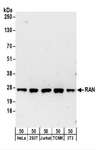 RAN Antibody - Detection of Human and Mouse RAN by Western Blot. Samples: Whole cell lysate (50 ug) from HeLa, 293T, Jurkat, mouse TCMK-1, and mouse NIH3T3 cells. Antibodies: Affinity purified rabbit anti-RAN antibody used for WB at 0.1 ug/ml. Detection: Chemiluminescence with an exposure time of 3 minutes.