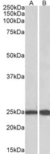 RAN Antibody - Goat Anti-RAN (aa 197-210) Antibody (0.1µg/ml) staining of Mouse (A) and Rat (B) Testis lysate (35µg protein in RIPA buffer). Primary incubation was 1 hour. Detected by chemiluminescencence.