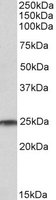 RAN Antibody - RAN antibody (1 ug/ml) staining of Human Testis lysate (35 ug protein/ml in RIPA buffer). Primary incubation was 1 hour. Detected by chemiluminescence.