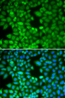 RAN Antibody - Immunofluorescence analysis of MCF-7 cells.