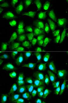 RAN Antibody - Immunofluorescence analysis of HeLa cells using RAN antibody. Blue: DAPI for nuclear staining.