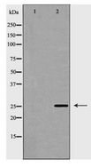 RAN Antibody - Western blot of RAN expression in LOVO cells