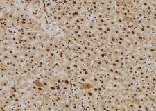 RAN Antibody - 1:100 staining mouse liver tissue by IHC-P. The sample was formaldehyde fixed and a heat mediated antigen retrieval step in citrate buffer was performed. The sample was then blocked and incubated with the antibody for 1.5 hours at 22°C. An HRP conjugated goat anti-rabbit antibody was used as the secondary.