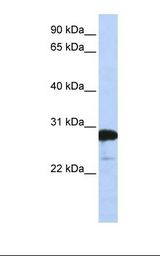 RANBP1 Antibody - 721_B cell lysate. Antibody concentration: 1.0 ug/ml. Gel concentration: 12%.  This image was taken for the unconjugated form of this product. Other forms have not been tested.