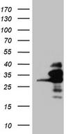 RANBP1 Antibody - HEK293T cells were transfected with the pCMV6-ENTRY control. (Left lane) or pCMV6-ENTRY RANBP1. (Right lane) cDNA for 48 hrs and lysed. Equivalent amounts of cell lysates. (5 ug per lane) were separated by SDS-PAGE and immunoblotted with anti-RANBP1. (1:2000)