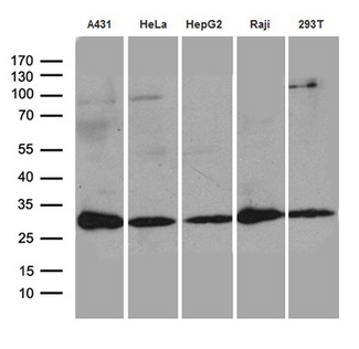 RANBP1 Antibody - Western blot analysis of extracts. (35ug) from 5 cell lines lysates by using anti-RANBP1 monoclonal antibody. (1:500)